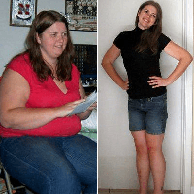 Mia Lost a Whopping 151 pounds with HCG Injections