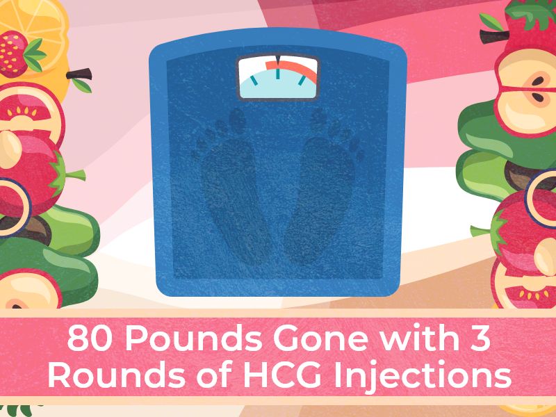 80 Pounds Gone with 3 Rounds of HCG Injections