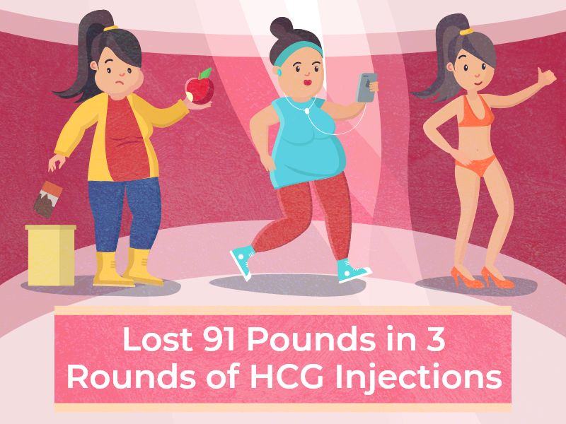 Lost91Poundsin3 RoundsofHCGInjections