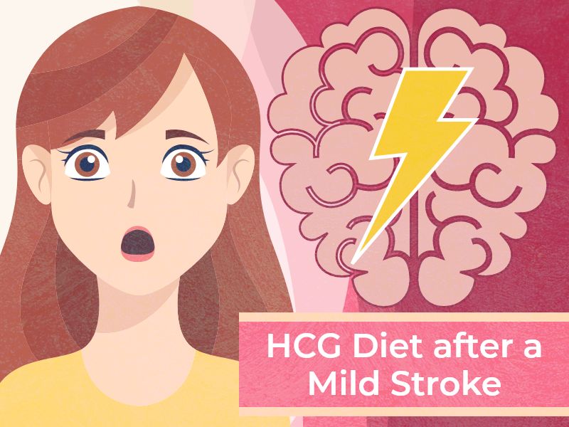 HCG Diet after a Mild Stroke