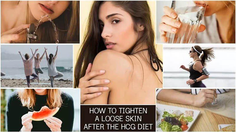 How to Tighten a Loose Skin after the HCG Diet