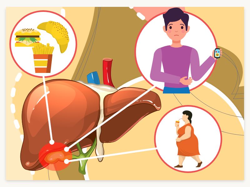 Causes of Gallbladder Disease