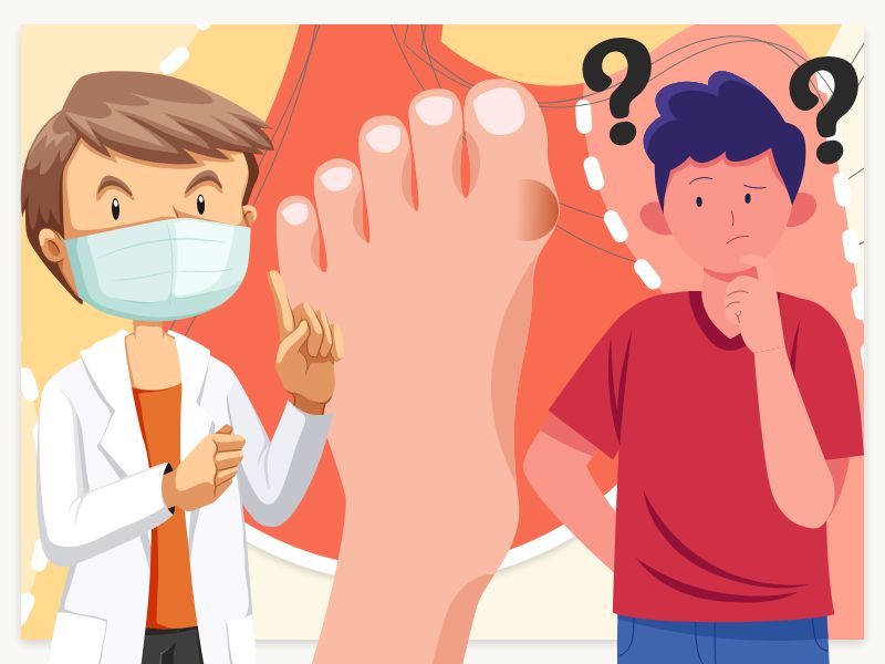 Is Gout Curable?