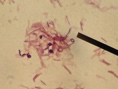 Lactobacillus Rhamnosus on a microscope with straw