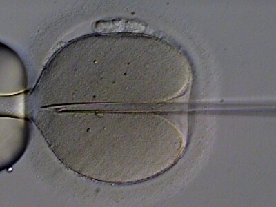 Injecting a sperm in an egg cell under a microscope